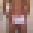 schlono