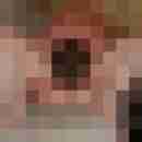 Carlchen