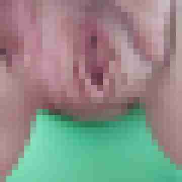 Hormonferkel
